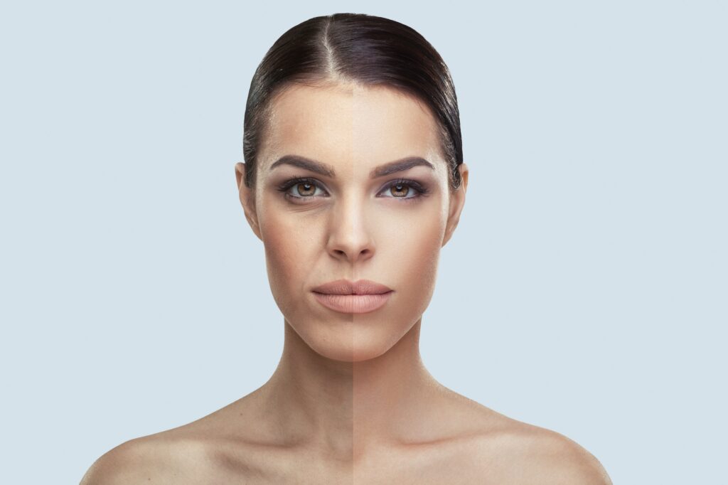 Woman face before and after beauty treatment